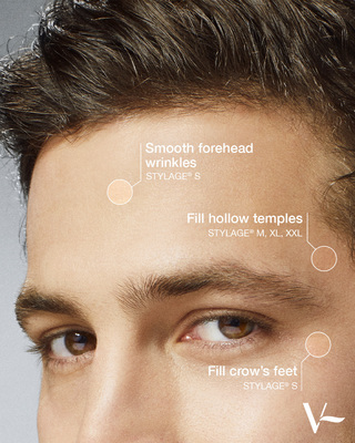 “Fillers are for women” - a commonly held opinion that is simply not true! 

Each product in the STYLAGE® range is formulated with its own specific rheology - otherwise known as its consistency, determined by its viscosity and elasticity. Each product has specific indications in both the male and the female anatomy.

Commonly treated areas in men include filling hollows in the temples, smoothing out wrinkles in the forehead and targeting the lines around the eyes known as crow’s feet.
.
*Medical Devices Class III, regulated health products bearing the CE marking (CE 0344). Only to be administered by appropriately trained healthcare professionals who are qualified or accredited in accordance with national law.

🇫🇷