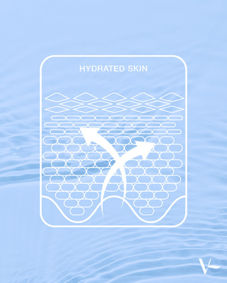 Dehydrated skin can dull our shine, appearing dry and tired. This is thanks to cells that are less plump and therefore less densely packed, leading to a loss of tone and structure in the dermis. Moisture can escape upwards through the skin’s layers, perpetuating the cycle, and leaving skin lined and aged 😖

Hydrated skin consists of plump cells that are packed tightly - providing elasticity and firmness, giving an all-round healthy and radiant appearance 💦

*Medical Devices Class III, regulated health products bearing the CE marking (CE 0344). Only to be administered by appropriately trained healthcare professionals who are qualified or accredited in accordance with national law.

#Vivacy #StyleYourAge #HyaluronicAcid #AestheticMedicine #Injections #FillerInjection #BeautyTreatment #WrinkleTreatment #NoSurgery #DermalFiller #Mesotherapy